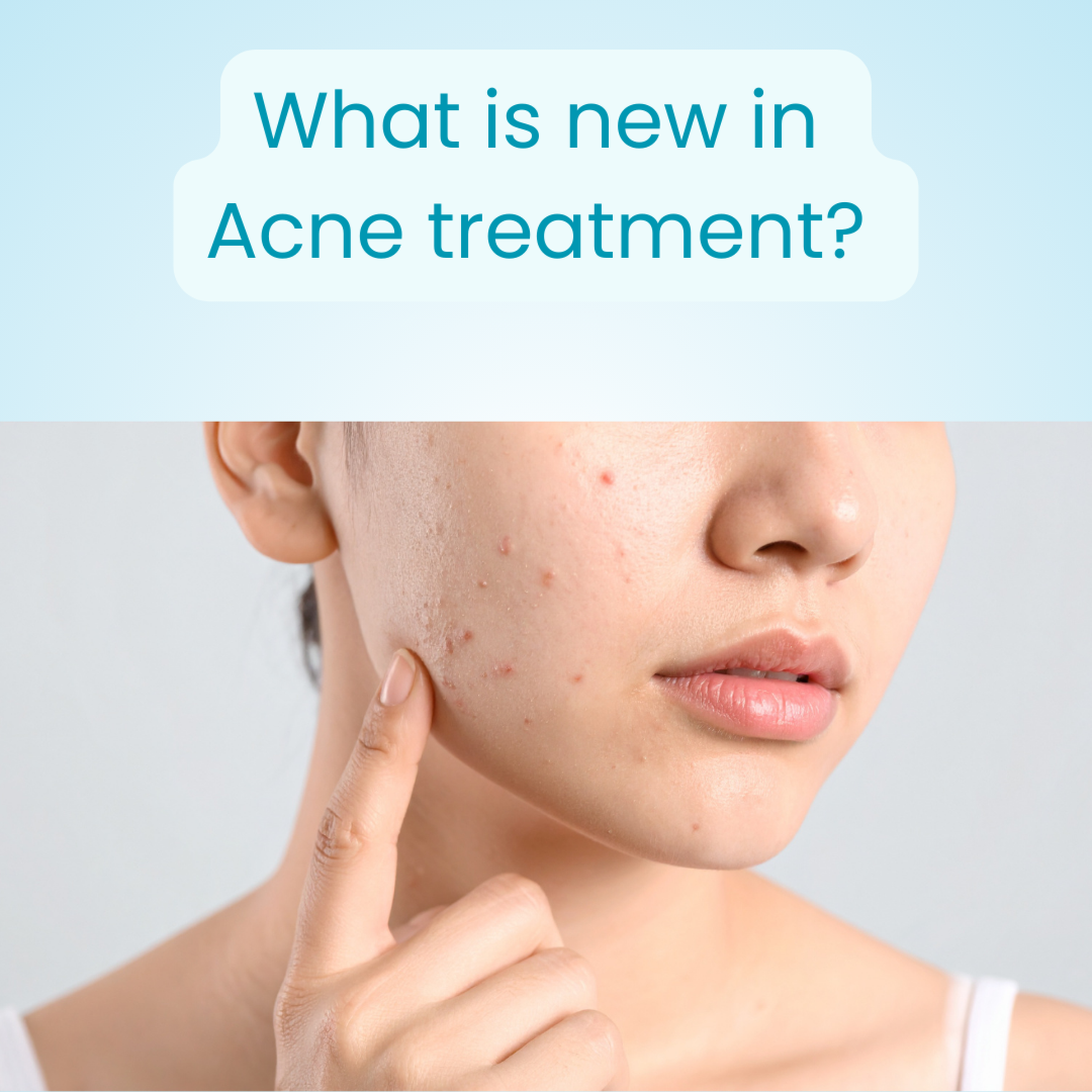 Clascoterone: The New-age Topical Androgen Blocker Changing the Way We Treat Acne